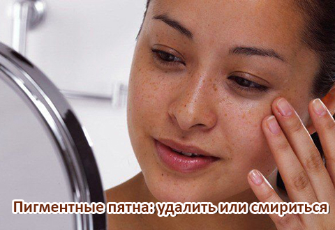 Пигментные пятна: удалить или смириться